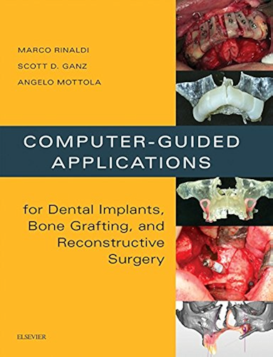 Download Computer-Guided Dental Implants and Reconstructive Surgery - E-Book: Clinical Applications (English Edition) PDF