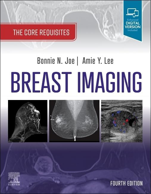 Diagnostic Breast Imaging 第2版 Diagnostic Imaging: Breast: 9780323548120: Medicine & Health