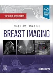Breast Ultrasound: 9780397516247: Medicine & Health Science