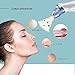 Bestidy Comedo Suction Microdermabrasion Diamond Machine, Electric Facial Pore Cleanser Nose Blackhead Cleaner Acne Remover Rechargeable Skin Peeling Cleaner Vacuum Extraction Tool (White)