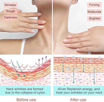 aliver retinol cream