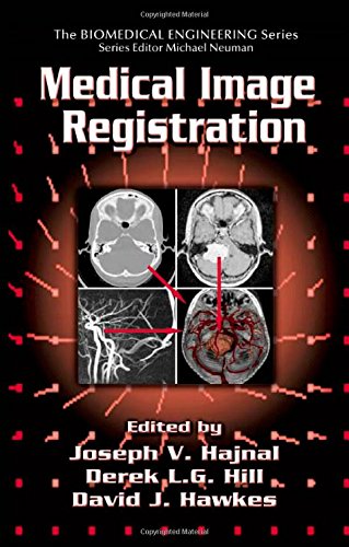 Medical Image Registration (Biomedical Engineering)