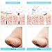 Blackhead Remover,B-YASS USB Rechargeable Blackhead Vacuum Electric Suction Pore Cleanser Skin Cleaner Exfoliating Acne Extractor Skin Firming Machine Tool with 4 Microcrystalline Heads