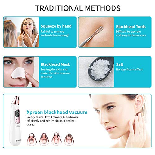 Blackhead Vacuum Remover, Xpreen Blackhead Remover Vacuum, Electric