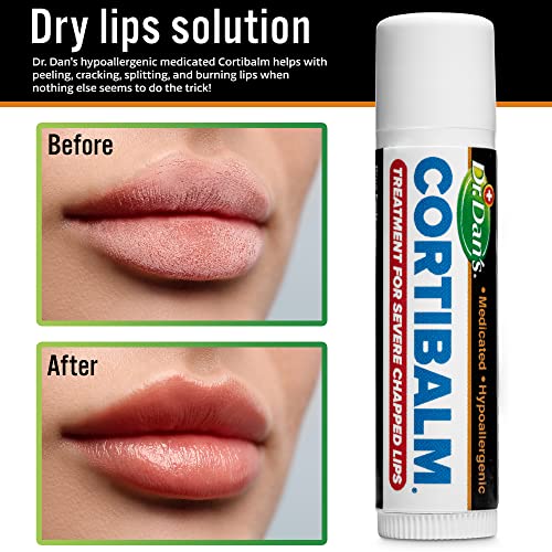 Dr. Dan's Cortibalm 1 Pack for Dry Cracked Lips Healing Lip Balm