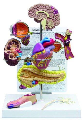 Diabetes Type 2 Anatomical Organ Model Set- Brain, Eye, Heart, Kidney, Artery, Pancreas, Foot