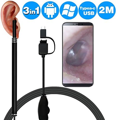 Copecam Ear Cleaning Endoscope, 3 in 1 USB Borescope Inspection Ear Wax Remover HD Camera Visual Earpick Tool with 6 Adjustable LED for Android, Windows, MAC, PC,Micro USB,Type c-Black