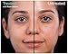 Hylamide Pore Delete, 1 Ounce