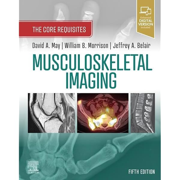 Amazon.com: Abdominal Imaging E-Book: The Core Requisites eBook