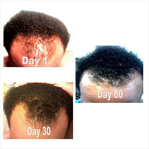 Natural Q. Hair Regrowth Spray 