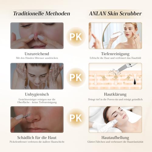 4 in 1 ANLAN Ultrasonic Skin Cleanser Facial Cleanser - Deep Cleansing, Vibrating Scrub, Facial Care and Blackhead Removal