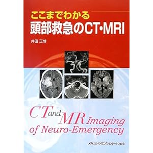 Kokomade wakaru tobu kyukyu no shiti emuaruai.