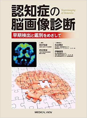 認知症の脳画像診断 早期検出と鑑別をめざして 西村 恒彦 武田 雅俊 松田 博史 伊藤 健吾 本 通販 Amazon