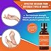 Wart Removal, Penetrates and Removes Common and Plantar Warts, Wart Remover Liquid, Plantar Warts Treatment