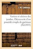 Image de Varices et ulcères des jambes, découverte d'un procédé simple de guérison (Sciences) (French Edition)