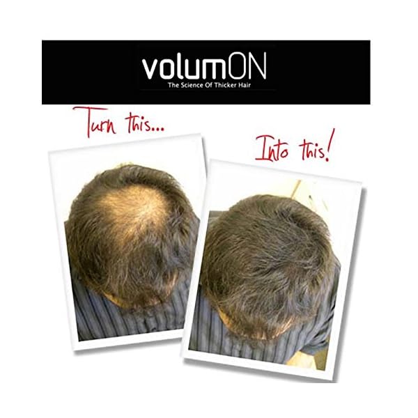 Volumon-Professional-Hair-Building-Fibres-Hair-Loss-Concealer-COTTON-28g-Get-Upto-30-Uses-CHOOSE-FROM-8-HAIR-SHADES-COLOURS-Dark-Brown Volumon Professional Hair Building Fibres- Hair Loss Concealer- COTTON- 28g- Get Upto 30 Uses- CHOOSE FROM 8 HAIR SHADES…