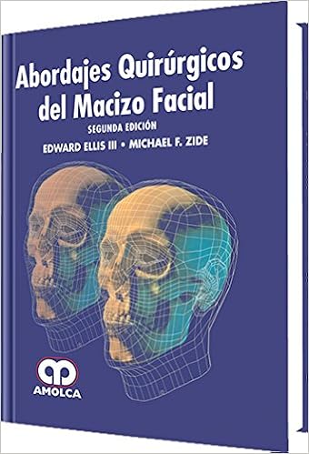 abordajes quirurgicos del macizo facial