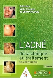 Acné