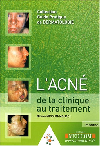 Acné