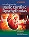 Introduction to Basic Cardiac Dysrhythmias