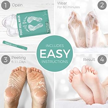 baby feet skin peel