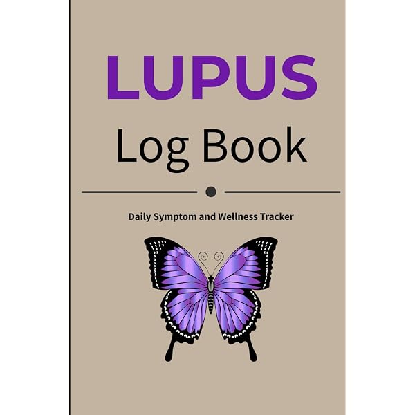 The Lupus Book: A Guide for Patients and Their Families: Wallace