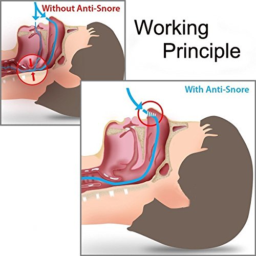 Wild Tribe Set of 8 Premium Anti Snore Aid To Prevent Snoring, Deviated Septum.Smarter Solution Against Snoring (Advanced Design Save Your Lungs)