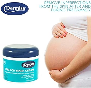 dermisa stretch mark cream