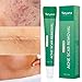 Tetyana naturals Scar Gel, Acne Scar Removal for Face & Body Old & New Scars from Cuts Stretch Marks, C-Sections & Surgeries With Natural Herbal Extracts Formula (15g)