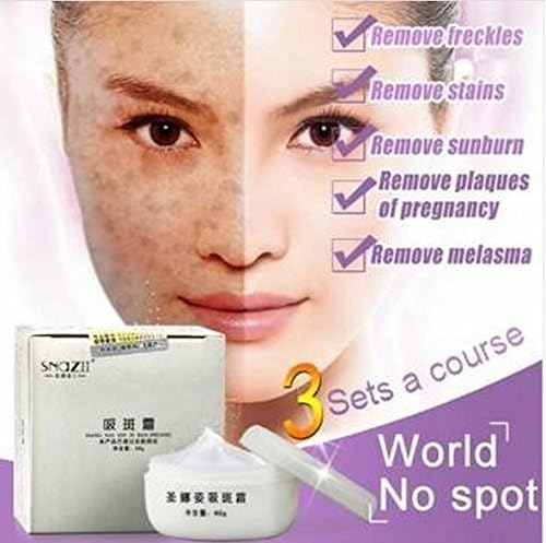 SNAZII Freckle Spot Removal Remover Repair Whitening Facial Eliminate Melanin Cream Moisturizing by GokuStore by GokuStore