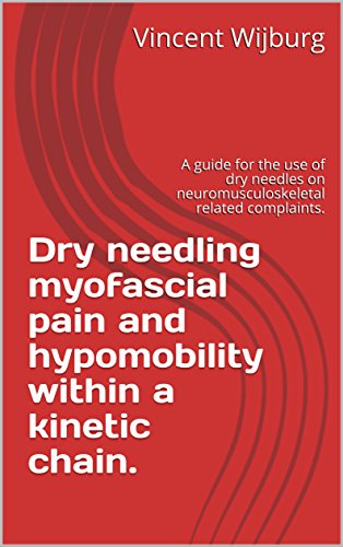 Dry needling myofascial pain and hypomobility within a kinetic chain.: A guide for the use of dry needles on neuromusculoskeletal related complaints.