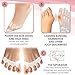 PampyFeet Silicone Toe Separators with Moisturizing Ankle Sleeves for Dry Cracked Heels for Men and Women - Bunion Corrector and Bunion Relief - HammerToe Straightener - Toe Spreaders/Spacers for Yoga