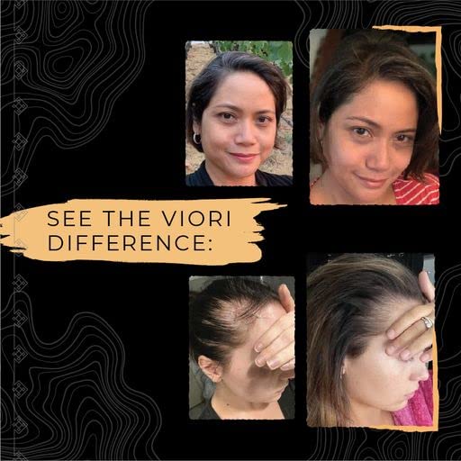 VIORI Terrace Garden Conditioner Bar Handcrafted with Longsheng Rice