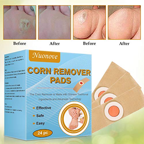 Corn Remover Pads, Corn Removal, Wart Removal, It is a Better Solution for People Who Suffer The Pain of Corn, Wart & Callus, 24Pcs/Box