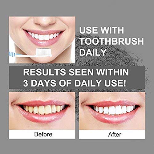 Activated Charcoal Teeth Whitening Powder - Liberex Natural Ultra Fine Teeth Whitener, Remove Tooth Stains and Freshen Breath for Sensitive Gum (1.1Oz/30g) (Mint)