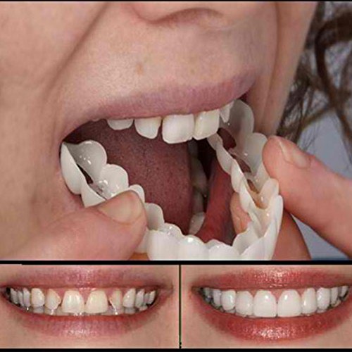 BaiMoon Cosmetic Upper Instant Smile Comfort Fit Flex Cosmetic Teeth, One Size Fits Most, Comfortable Upper Veneer