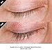 Grande Cosmetics GrandeLASH-MD - 6 month supply, 4 ml