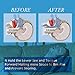 Snore Stopper - Anti Snoring Devices, Snore Reduction Night Guard for Quiet Night