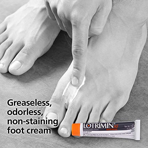 3 Lotrimin+Clotrimazole+Antifungal+Treatment+Clinically