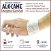 Alocane® Emergency Burn Max Strength Pads Fast Pain and Itch Relief for Minor Burns, Sunburn, Kitchen, Radiation, Chemical, First Degree Burns, First Aid Treatment Burn Care, 10 pads 2