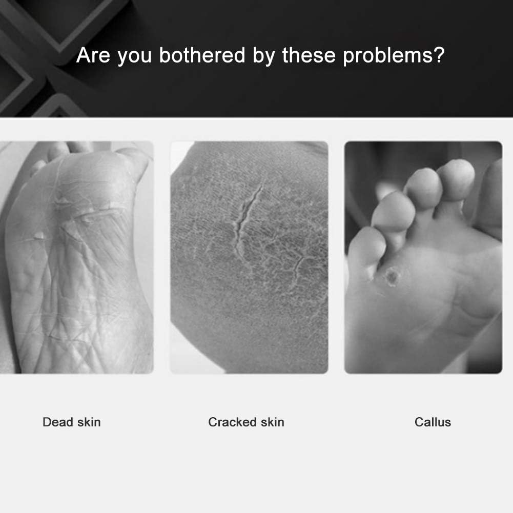 Professional Foot Scrubber - Image 5
