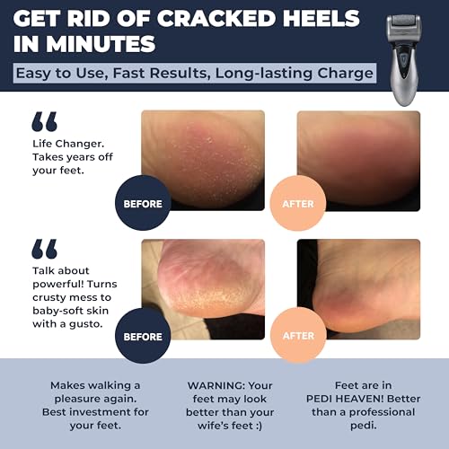Electric Callus Remover for Feet: Best Pedicure Tools for Men by Own Harmony with 3 Rollers (Powerful), Electronic Pedi Spa Foot File Care - Perfect for Hard, Cracked, Dry, Dead Skin (USB Cable)