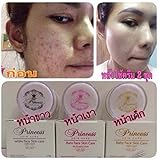 10G.Princess Skin Care Whitening Acne Cream, Baby Face,Aura Face,White Face