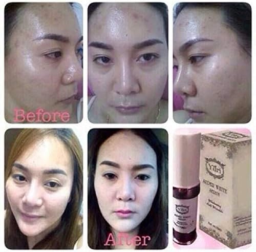 15ML X 1 Yuri Super Serum Whitening Skincare +Nano Collagen Cream Dark Spots Acne Freckle