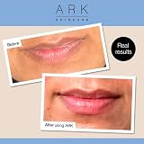 ARK Skincare Advanced Action Plumping Lip Cream 30ml Peptides Macadamia Smooths view 4
