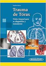 Trauma de torax: Visión integral para su diagnóstico y tratamiento