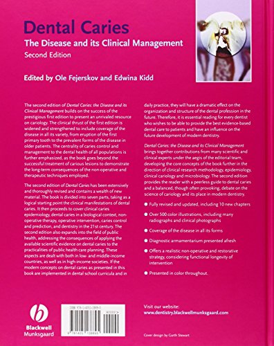 Dental Caries: The Disease and Its Clinical Management - //medicalbooks.filipinodoctors.org