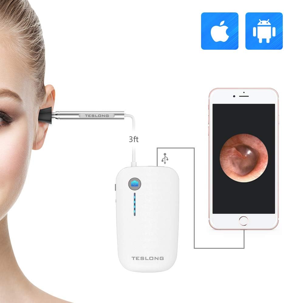 Teslong iPhone Otoscope, USB 720P HD Ear Canal Scope Amazon.co.uk