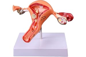 Human Female Uterus and Ovary Model, Female Genital Organ, Reproductive Organ Model, Uterine Medical Teaching Anatomical Gyne