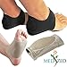 MEDIZED&reg; Plantar Fasciitis Therapy Wrap Heel Foot Pain Arch Support Ankle Brace Insole Orthotic ... (Beige Arch Sleeve and Black Heel Wrap) primary